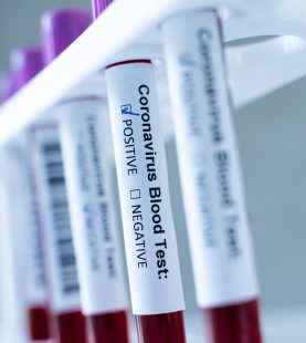 MODULE 7 – LABORATORY SAMPLE MANAGEMENT